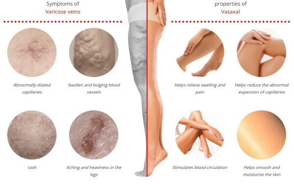 Izvleček kostanja - naravna rešitev za krčne žile in sijočo kožo